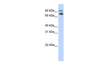 FOXK2 Rabbit Polyclonal Antibody