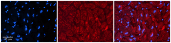 ZFP36L1 Rabbit Polyclonal Antibody