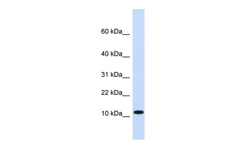 HMGN1 Rabbit Polyclonal Antibody
