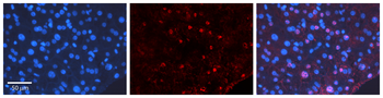 CEBPD Rabbit Polyclonal Antibody
