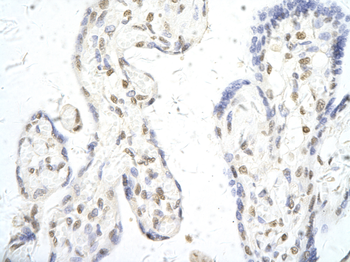 ELK1 Rabbit Polyclonal Antibody