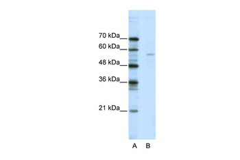 ELK1 Rabbit Polyclonal Antibody