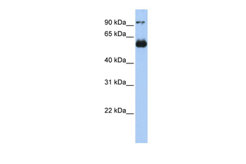 ETS2 Rabbit Polyclonal Antibody