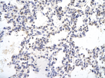 SMAD4 Rabbit Polyclonal Antibody
