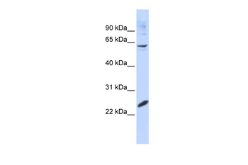 SMAD4 Rabbit Polyclonal Antibody