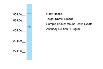 SMAD4 Rabbit Polyclonal Antibody