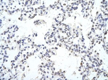 MAF Rabbit Polyclonal Antibody