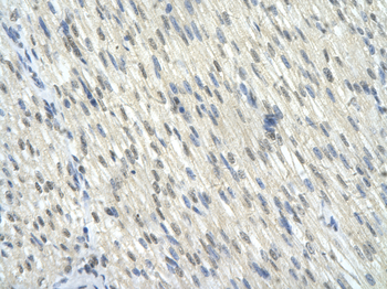 KLF10 Rabbit Polyclonal Antibody