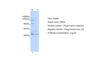 RBM5 Rabbit Polyclonal Antibody