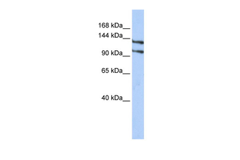 RBM5 Rabbit Polyclonal Antibody