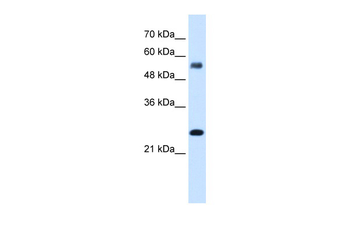 SMAD1 Rabbit Polyclonal Antibody