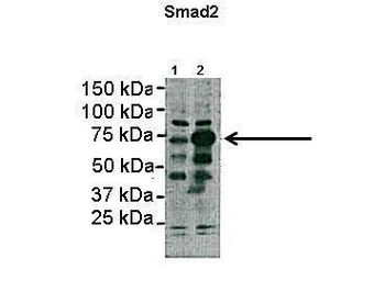SMAD2 Rabbit Polyclonal Antibody