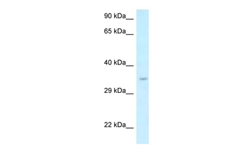 Six1 Rabbit Polyclonal Antibody