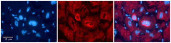 NFATC1 Rabbit Polyclonal Antibody