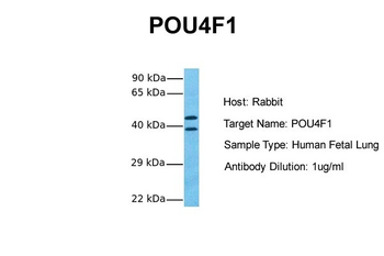 POU4F1 Rabbit Polyclonal Antibody