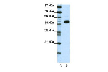 TADA3L Rabbit Polyclonal Antibody
