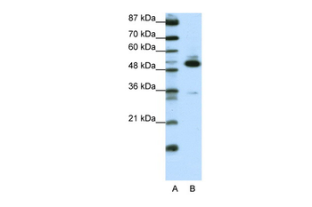 TADA3L Rabbit Polyclonal Antibody