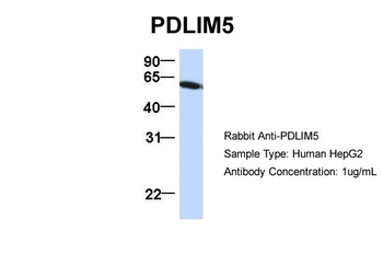 PDLIM5 Rabbit Polyclonal Antibody