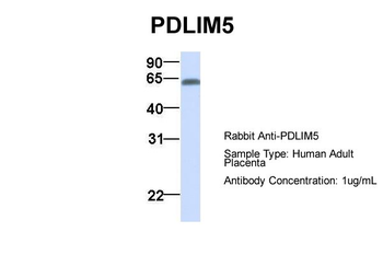 PDLIM5 Rabbit Polyclonal Antibody