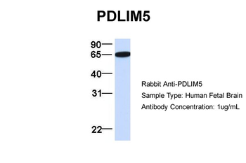 PDLIM5 Rabbit Polyclonal Antibody