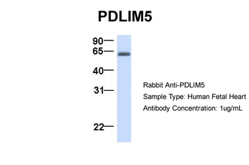 PDLIM5 Rabbit Polyclonal Antibody