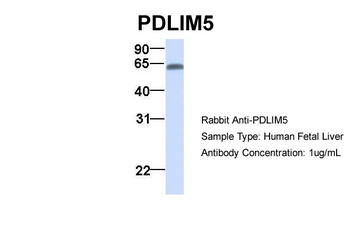 PDLIM5 Rabbit Polyclonal Antibody