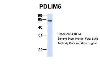 PDLIM5 Rabbit Polyclonal Antibody
