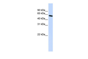 PDLIM5 Rabbit Polyclonal Antibody