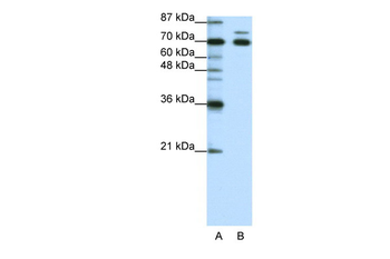TRIM16 Rabbit Polyclonal Antibody