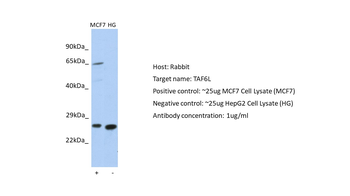 TAF6L Rabbit Polyclonal Antibody