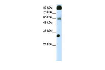CTCF Rabbit Polyclonal Antibody