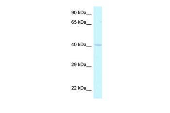 Hoxa2 Rabbit Polyclonal Antibody