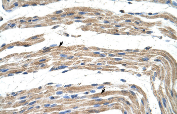 ZNF197 Rabbit Polyclonal Antibody