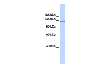 SUPT16H Rabbit Polyclonal Antibody