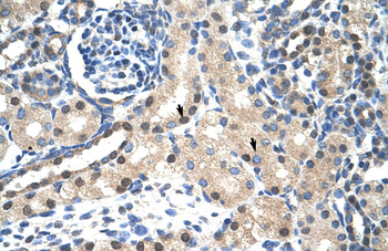 STAT1 Rabbit Polyclonal Antibody