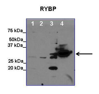 RYBP Rabbit Polyclonal Antibody