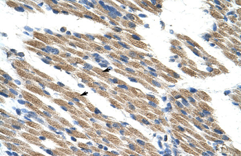 KEAP1 Rabbit Polyclonal Antibody