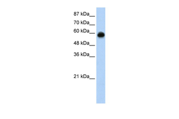 KEAP1 Rabbit Polyclonal Antibody