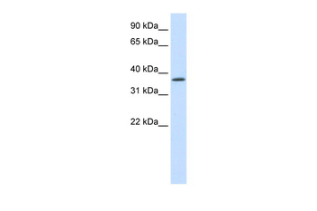 SAP30BP Rabbit Polyclonal Antibody