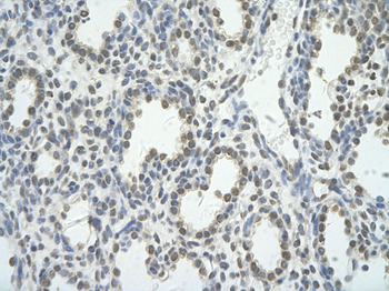 BRD7 Rabbit Polyclonal Antibody
