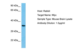 NFYC Rabbit Polyclonal Antibody