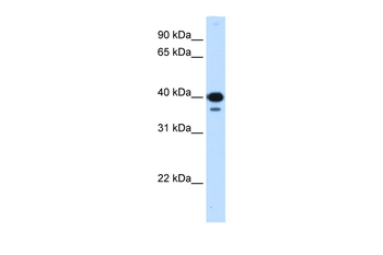 NFYC Rabbit Polyclonal Antibody