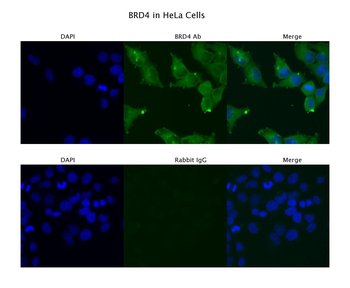 BRD4 Rabbit Polyclonal Antibody