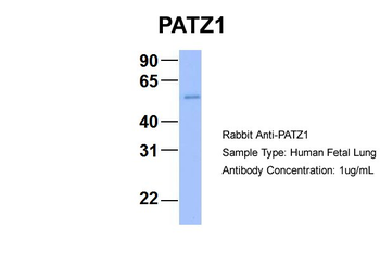 PATZ1 Rabbit Polyclonal Antibody