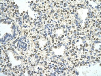 PATZ1 Rabbit Polyclonal Antibody