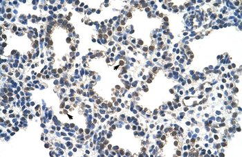 RCOR1 Rabbit Polyclonal Antibody
