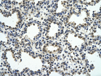 RCOR1 Rabbit Polyclonal Antibody