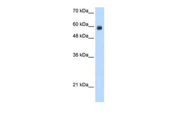 RCOR1 Rabbit Polyclonal Antibody