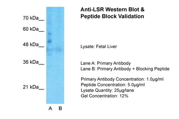 LSR Rabbit Polyclonal Antibody