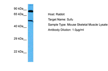 SUFU Rabbit Polyclonal Antibody